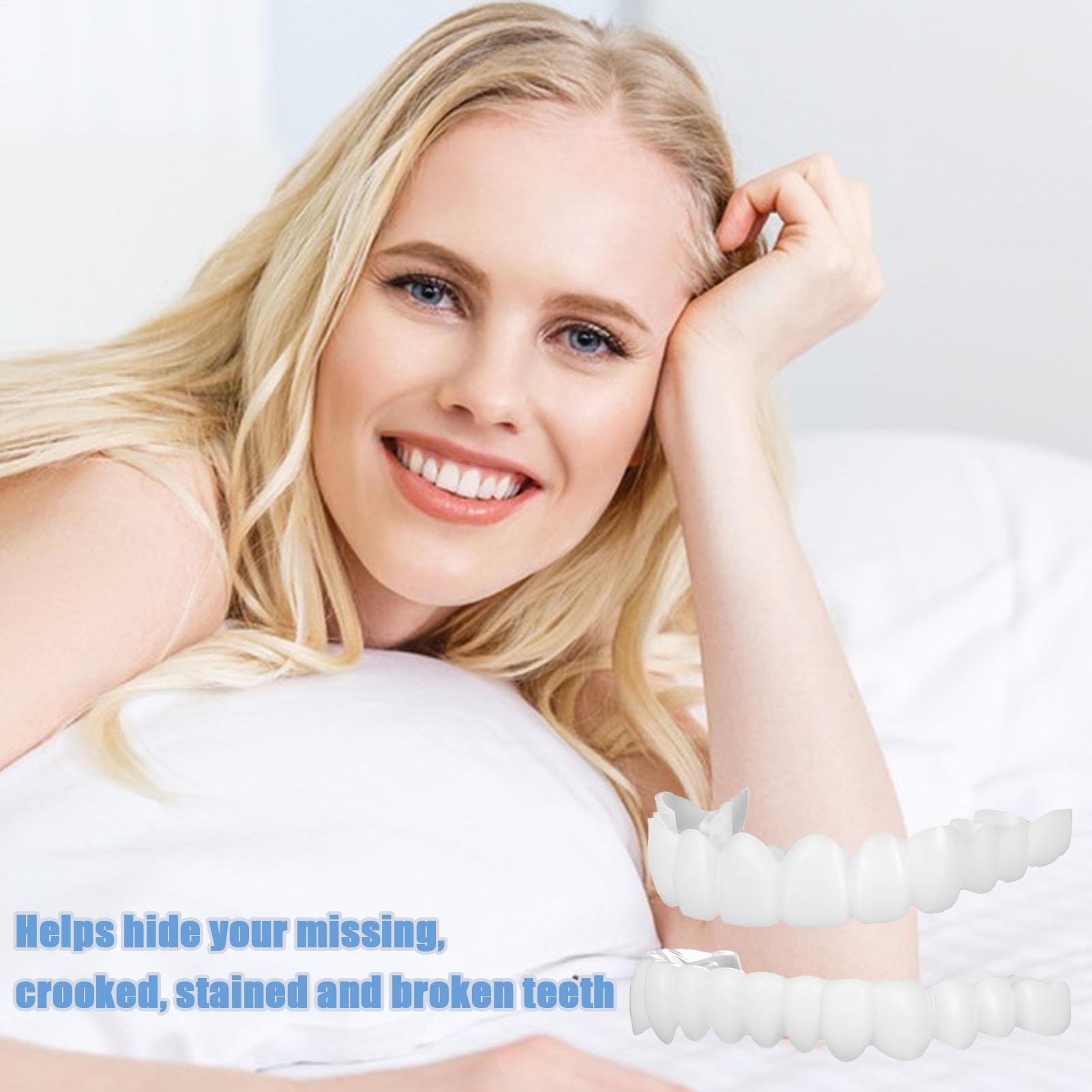 Kit Gigi Snap-on Veneer, Gigi  - Teeth Whitening In Office ulasan dan harga