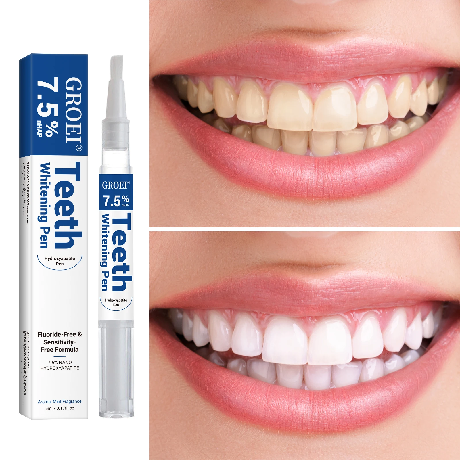 Pena Pemutih Gigi Hidroksiapat - Teeth Whitening Near Me ulasan dan harga