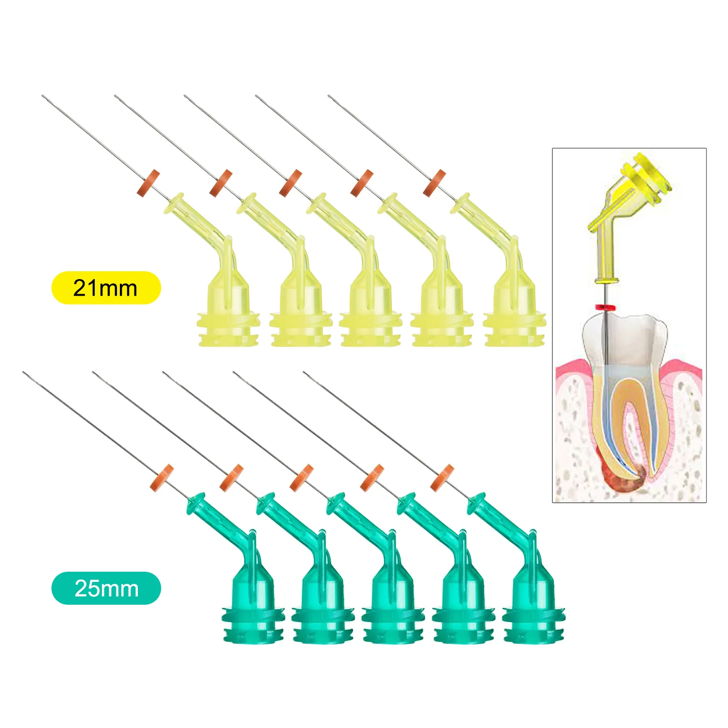 10 buah ujung jarum Endo iriga - Teeth Whitening Tips ulasan dan harga