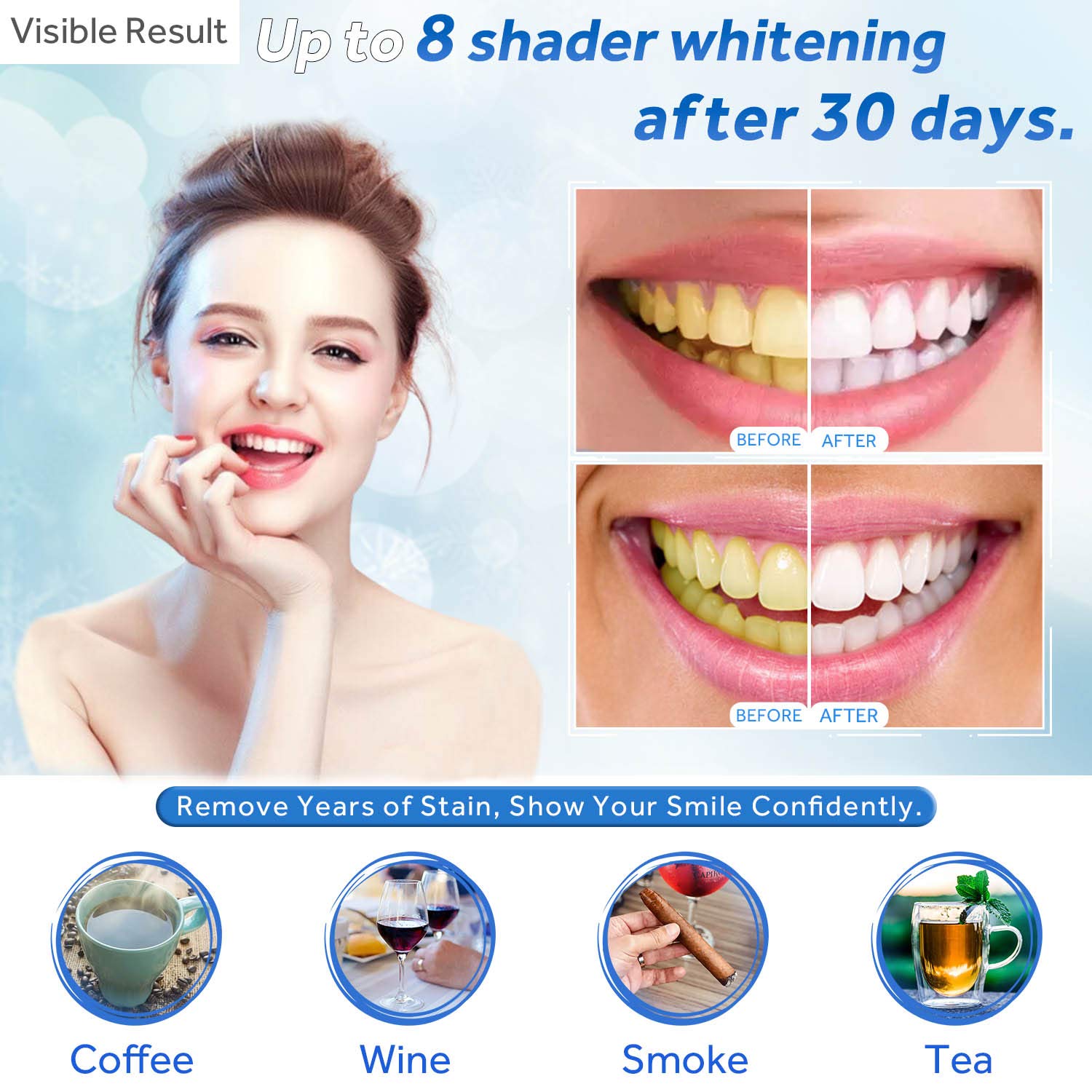 Gel Pemutih Gigi Isi Ulang Syr - Teeth Whitening Near Me ulasan dan harga