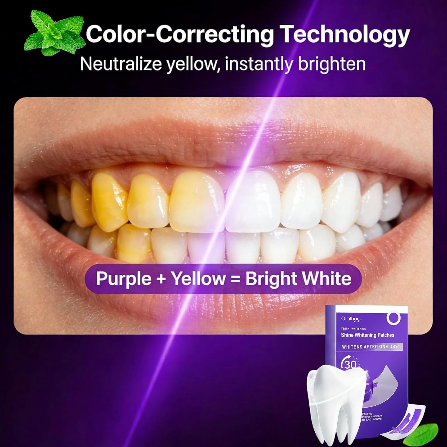 Paket Pemutih Gigi Ungu – Stri - Teeth Whitening In Office ulasan dan harga