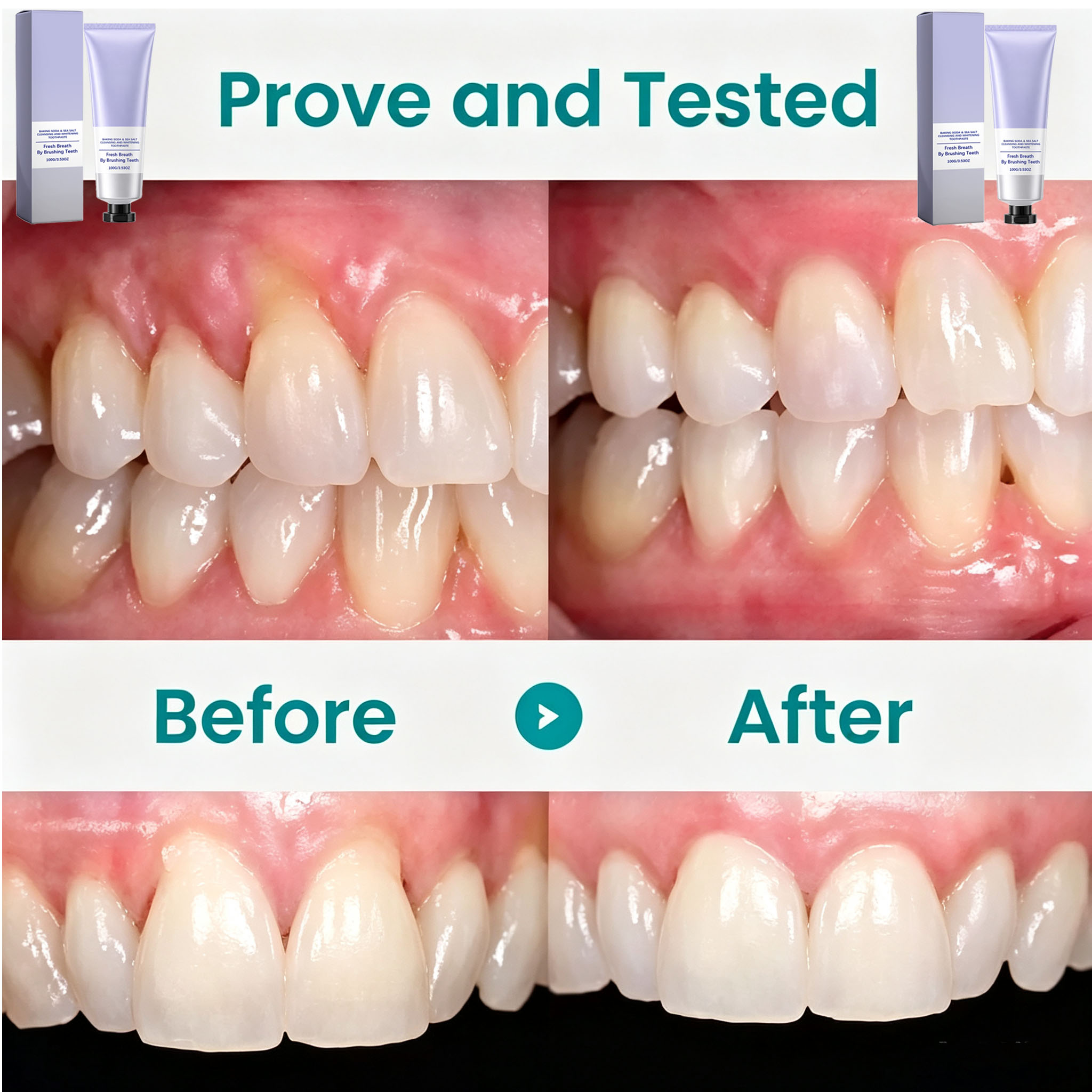 Pasta Gigi Soda Kue & Garam La - Teeth Whitening With Baking Soda ulasan dan harga
