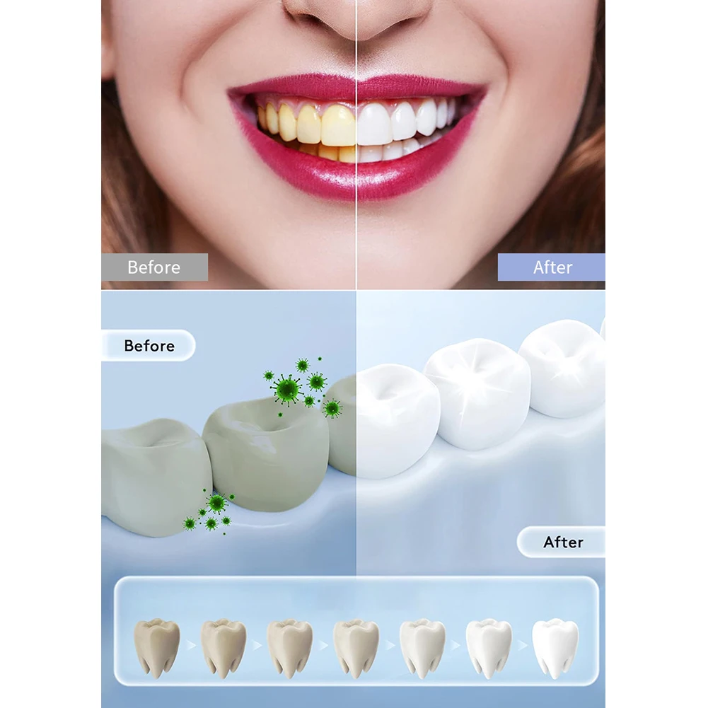 1 Buah Lampu Pemutih Gigi LED  - Teeth Whitening In Office ulasan dan harga