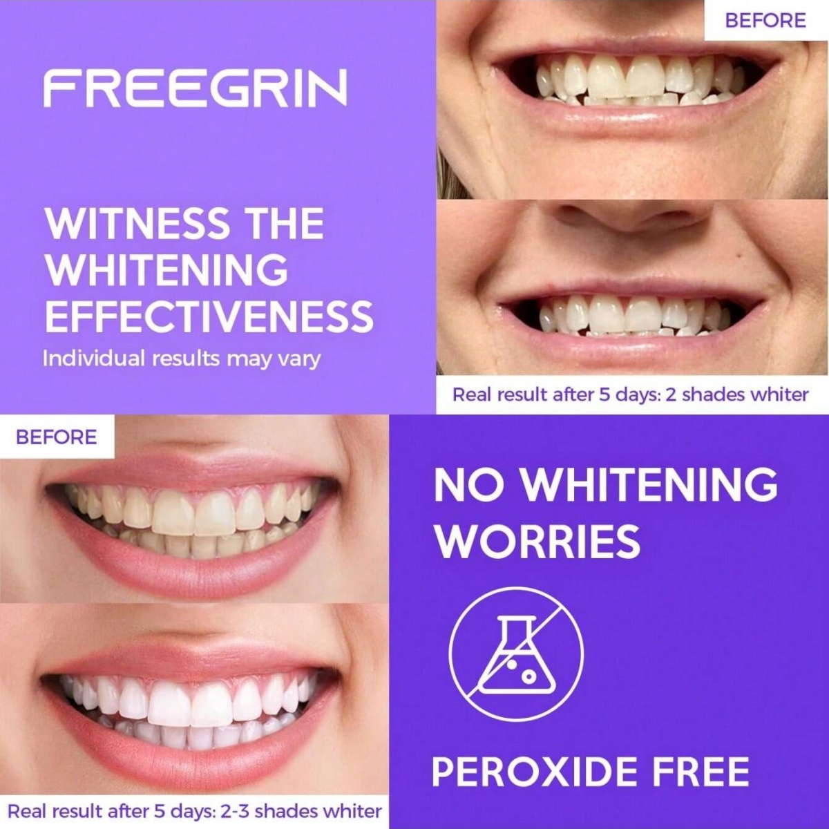 Stiker Gigi Pemutih Mewah 7/14 - Teeth Whitening In Office ulasan dan harga