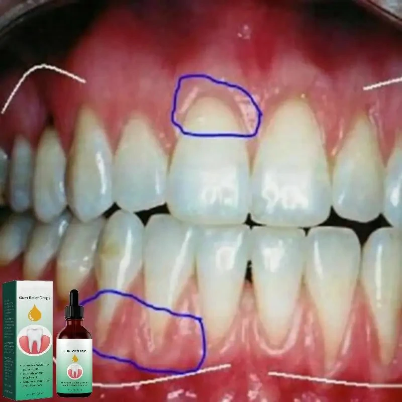 Tetesan perbaikan gusi, penghi - Teeth Whitening Paste ulasan dan harga