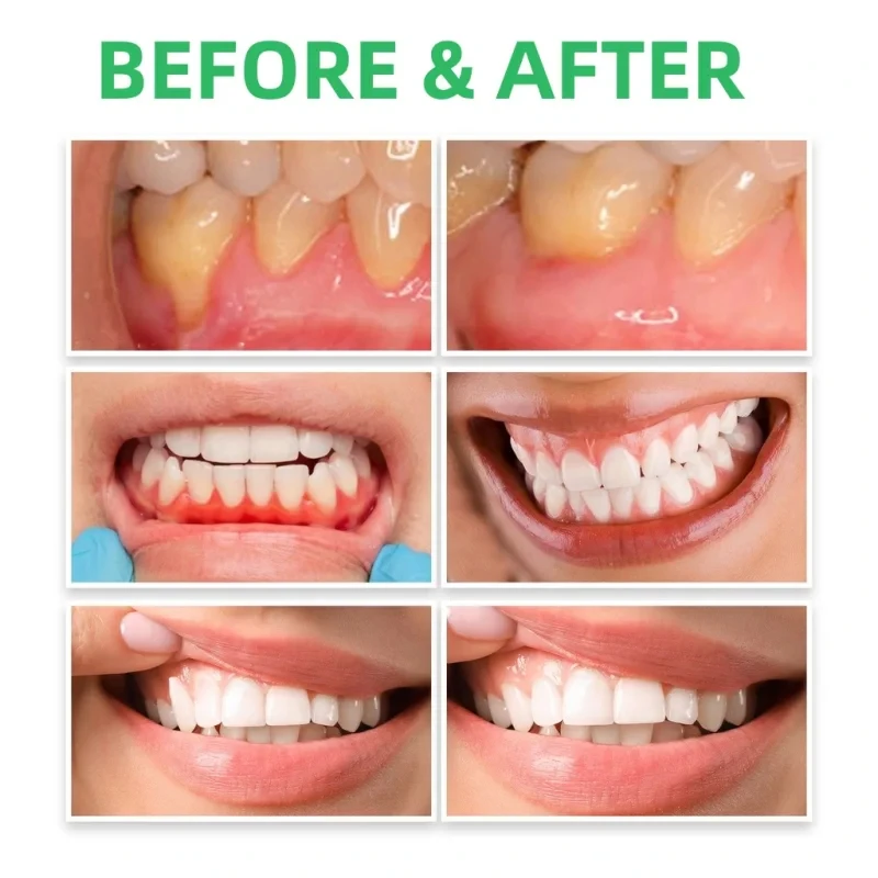 Tetesan perbaikan gusi, penghi - Teeth Whitening Paste ulasan dan harga